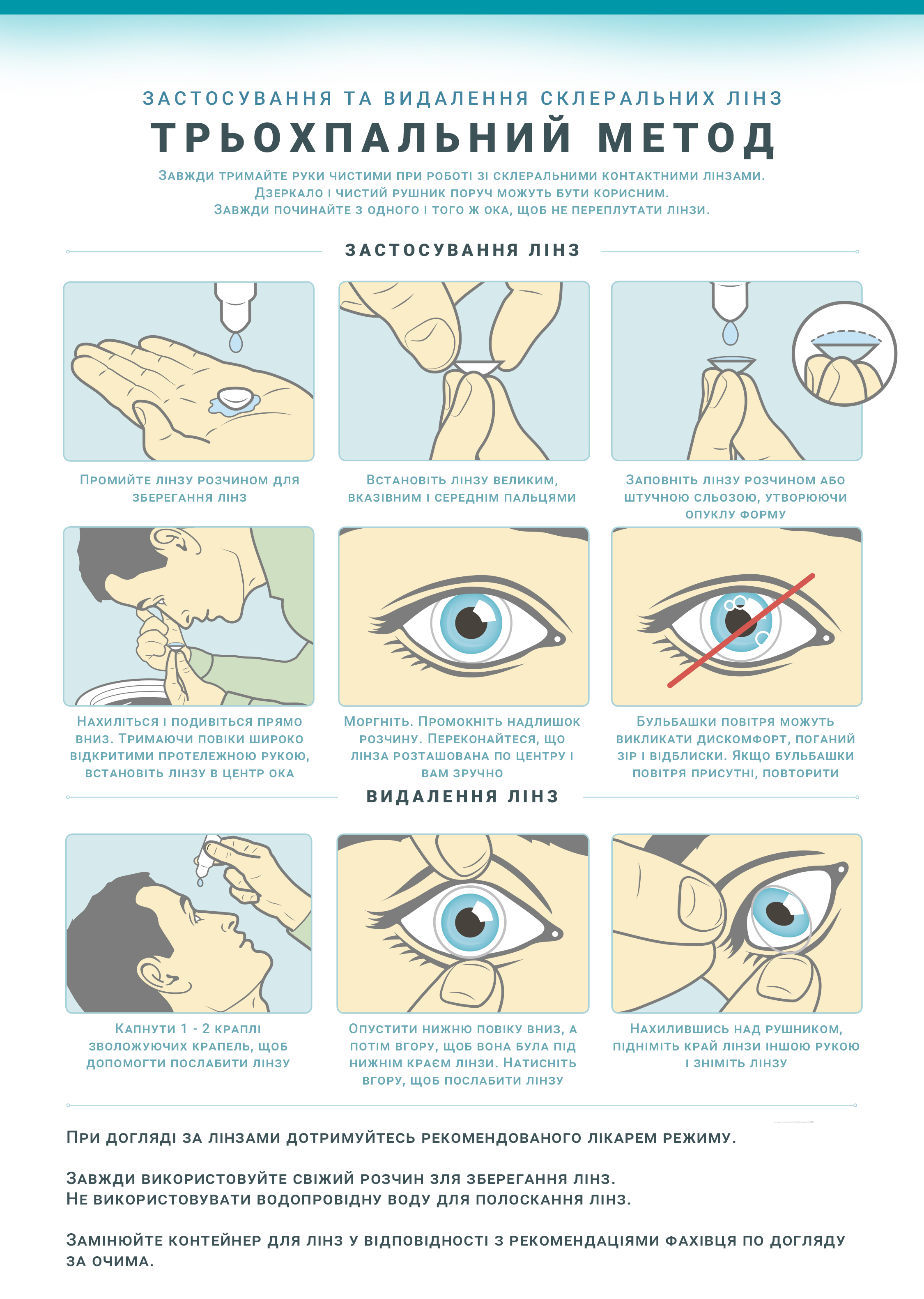 Застосування та видалення склеральних лінз
