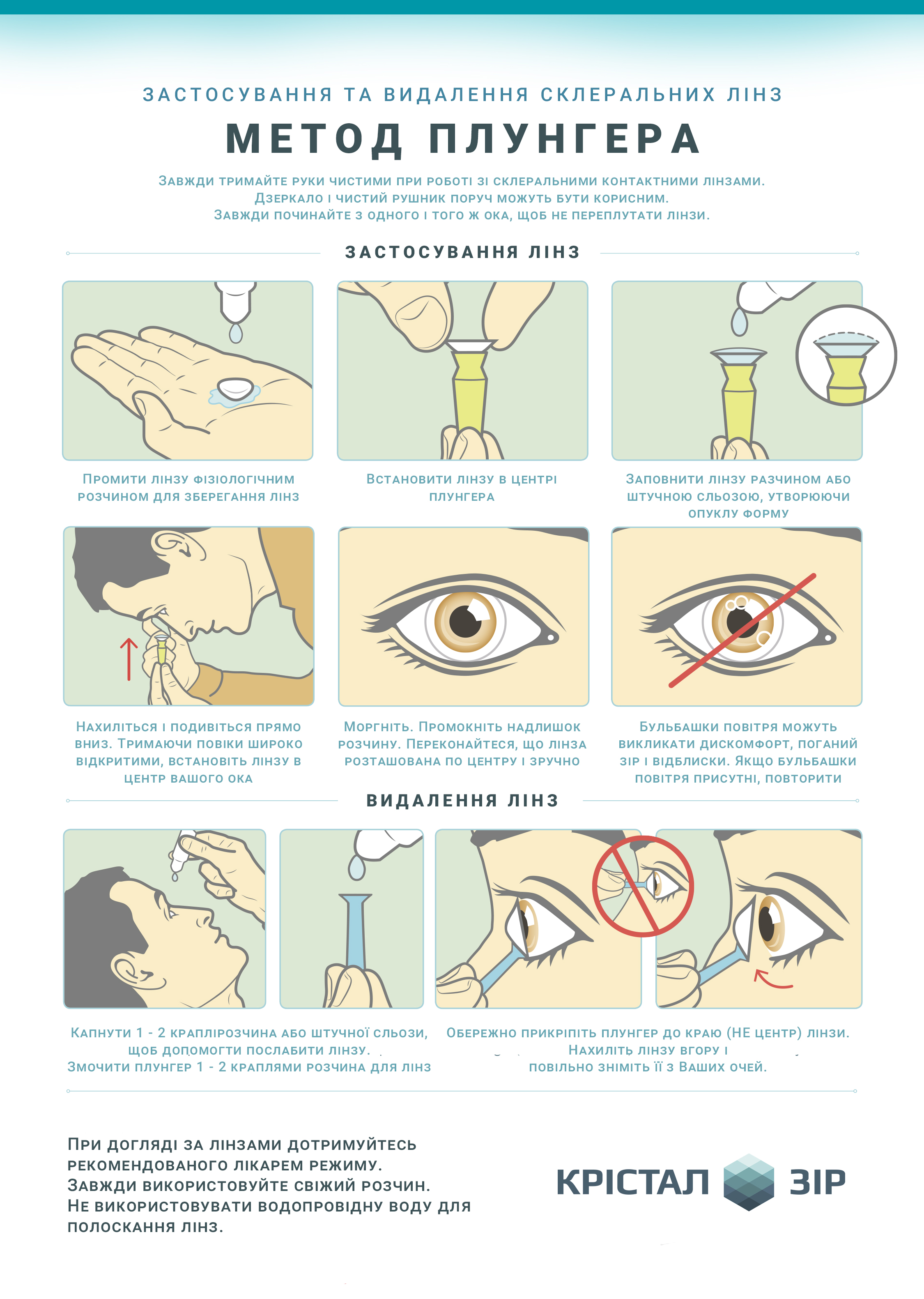Застосування та видалення склеральних лінз